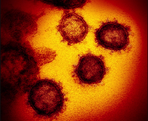 image of coronavirus